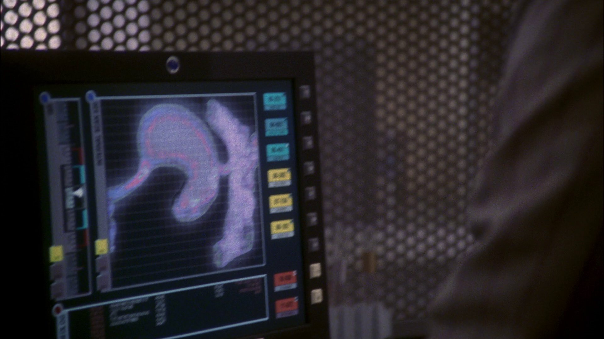 extant_StarTrek_ENT_1x13-DearDoctor_0467.jpg